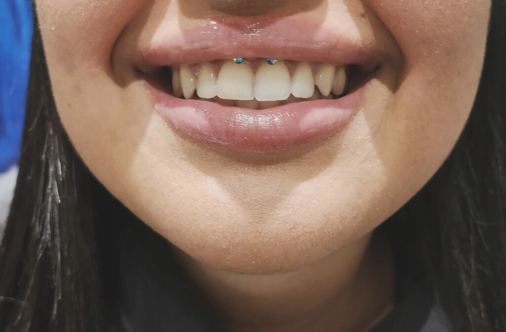 Piercing Smiley Par Leonie Kats Tattoo & Piercing Piercing à Troyes